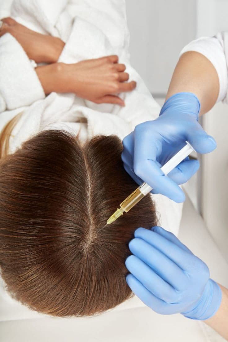 How to Prevent Hair Loss with Mesotherapy