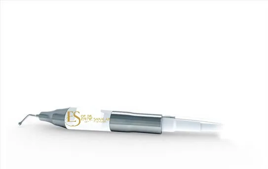 Modern piezo rhinoplasty — ultrasonic surgical technology
