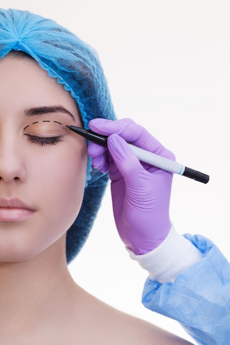 Blepharoplasty in Turkey: Eyelid Surgery Guide for International Patients